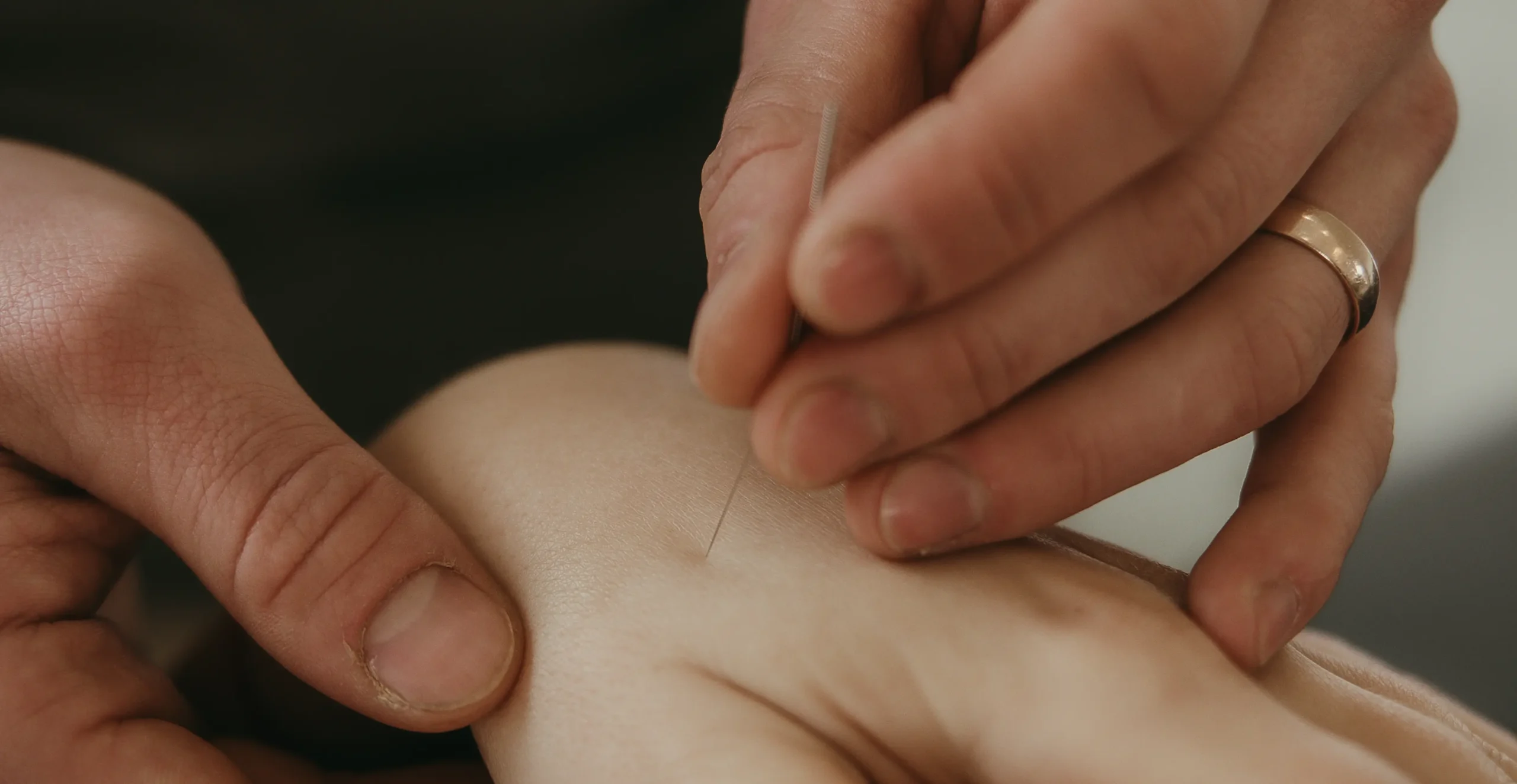 Acupuncture Aberdeen Lukasz
