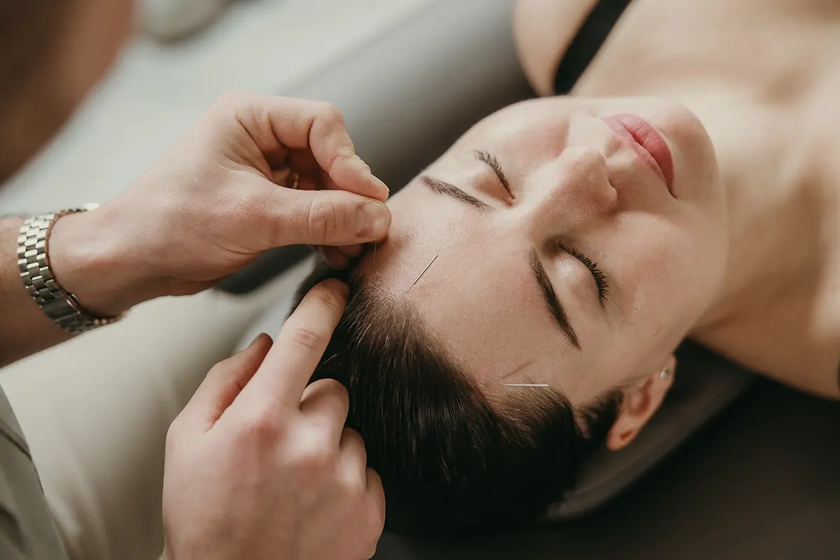 Acupuncture Aberdeen